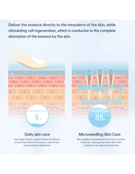 Dr. Pen Mikroadatu ierīce, dermapens A11 Ultima PRO, ar akumulatoru