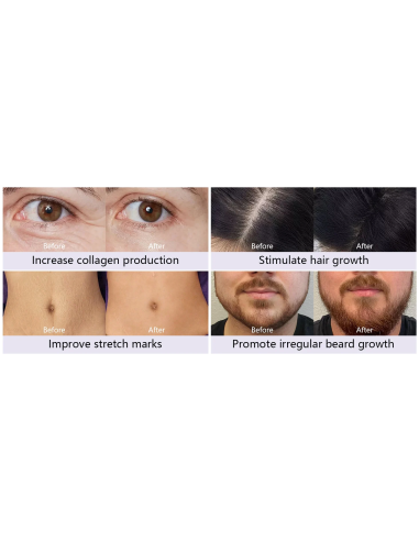 Dr. Pen Mikroadatu ierīce, dermapens...