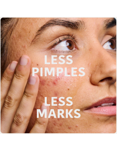 IROHA NATURE ACNE PRONE Anti-blemish...