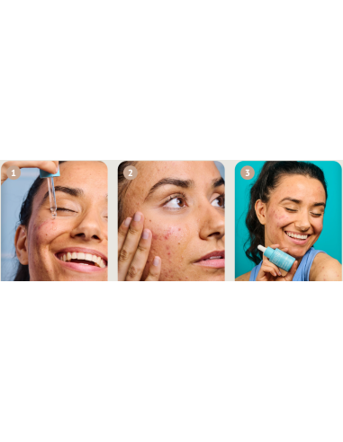 IROHA NATURE ACNE PRONE Serums ar...